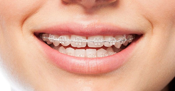 زیبایی دندان در تبریز