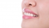 انواع روکش های دندانی 2 + لیست دندانپزشکان تبریز