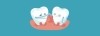 علت درد بعد از کامپوزیت دندان
