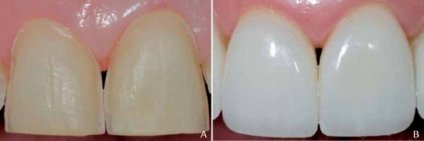 بهترین دندانپزشک تبریز در حوزه دندانپزشکی زیبایی